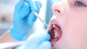 ارتودنسی دندان سرامیکی